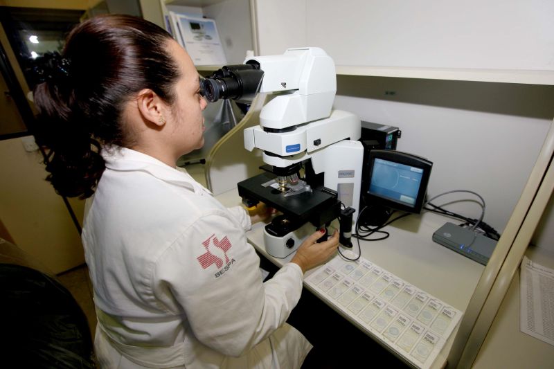notícia: Lacen é referência em exames para diagnosticar lesões de colo de útero