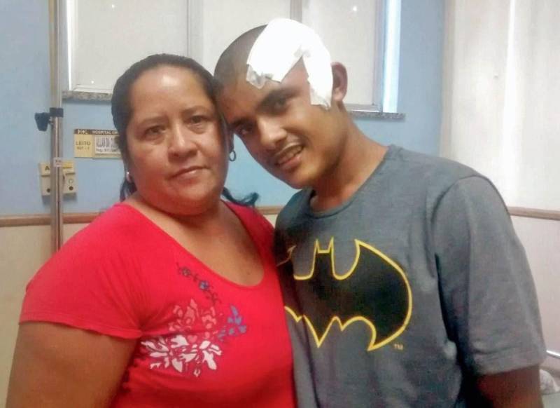 O soldador Allan Barreirinhas (d), 27, foi diagnosticado com epilepsia após sofrer um acidente de carro, há cinco anos. A doença neurológica é caracterizada por descargas elétricas anormais e excessivas no cérebro, que podem causar convulsões, espasmos musculares e perda de consciência. No último dia 19, ele se tornou o primeiro paciente submetido à primeira cirurgia de amígdalo-hipocampectomia no Sistema Único de Saúde (SUS) no Pará, feita pela equipe de neurocirurgia do Hospital Ophir Loyola. O procedimento cirúrgico – que durou cerca de quatro horas – tem por objetivo o melhor controle das crises convulsivas, livrando o paciente, em alguns casos, do uso de medicamentos. De 40% a 70% dos pacientes submetidos à cirurgia conseguem o controle total das crises. A equipe comemora o estado de Allan, que teve alta na última quinta-feira (22), sem apresentar nenhuma sequela. Ele vai passar por acompanhamento ambulatorial para verificar o ajuste de medicação, progressivo, ou até mesmo a retirada total dos remédios.
FOTO: ASCOM / HOL
DATA: 27.03.2018
BELÉM - PARÁ <div class='credito_fotos'>Foto: ASCOM HOL | <a href='/midias/2018/originais/087aff1d-470d-49b0-b79f-e86c984bc366.jpg' download><i class='fa-solid fa-download'></i> Download</a></div>