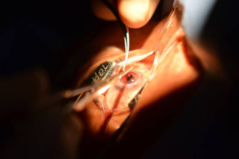 Em todo Pará, 857 pessoas aguardam na fila de espera por um transplante de córnea. Mas, a cada dia, o número de captações do tecido cresce e aumenta a esperança de quem espera por uma doação para voltar a enxergar, com um projeto desenvolvido pelo Banco de Olhos no Hospital Ophir Loyola. O serviço é o único na rede estadual que atua no recolhimento, avaliação, preservação e destinação de córneas em consonância com a Central de Transplante da Secretaria Estadual de Saúde (Sespa).
FOTO: ASCOM / HOL
DATA: 06.06.2018
BELÉM - PARÁ <div class='credito_fotos'>Foto: ASCOM HOL | <a href='/midias/2018/originais/4660e1dc-8578-41fa-a188-0db512037e94.jpg' download><i class='fa-solid fa-download'></i> Download</a></div>