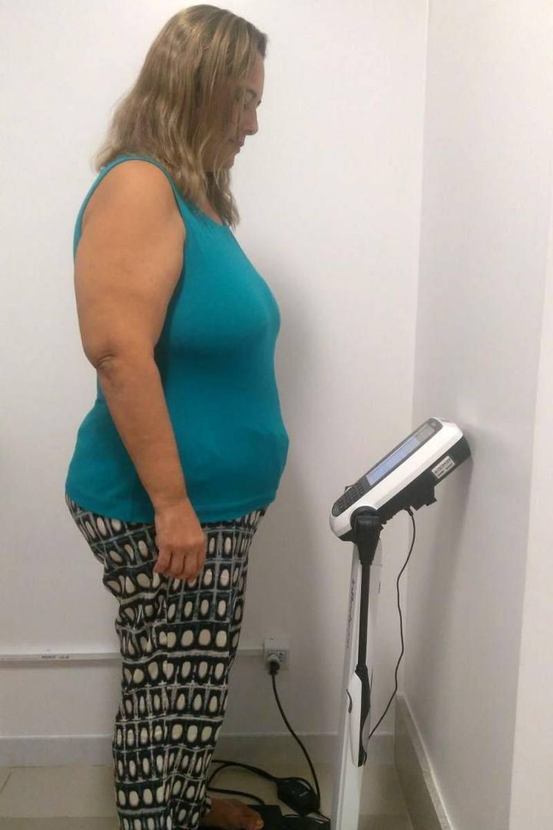 Avaliação mais precisa da composição corporal na análise da quantidade de músculos, ossos, água e gordura no corpo humano. São alguns dos principais benefícios oferecidos pelo exame de bioimpedância que é a mais nova tecnologia à disposição dos usuários do Hospital Jean Bitar (HJB), em Belém (PA), que auxilia na assistência durante a rotina de consultas ambulatoriais na especialidade de endocrinologia. Na foto, a autônoma Ana Cláudia Porto Matos que aos 47 anos, que ao iniciar acompanhamento para a cirurgia bariátrica no Hospital Jean Bitar, pesava 120 quilos e após o procedimento cirúrgico, realizado dia 30 de janeiro deste ano, já conseguiu reduzir para 98 kg.
FOTO: ASCOM HJB
DATA: 13.04.2018
BELÉM - PARÁ <div class='credito_fotos'>Foto: ASCOM HJB | <a href='/midias/2018/originais/7429009c-eb2a-42d5-b7f5-a2724bd09d77.jpg' download><i class='fa-solid fa-download'></i> Download</a></div>