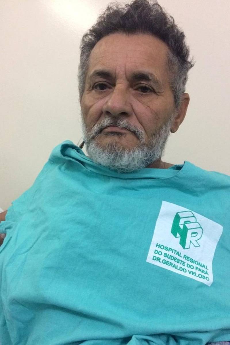 Nesta semana, a lei federal nº 11.705, mais conhecida como Lei Seca, completou dez anos. De lá para cá, mesmo com o aumento no rigor da fiscalização em relação aos motoristas que dirigem embriagados, o problema continua sendo uma das principais causas de morte no trânsito no País. Para quem sobrevive à experiência, na maioria das vezes, a recuperação não é fácil. Ao lado de Francisco, seu Geraldo Pinheiro, de 60 anos (foto), também se recupera de um acidente de trânsito. Embora a causa do trauma não tenha sido a ingestão de bebida alcoólica, ele conta que há 15 anos viveu experiência semelhante a do colega de enfermaria.
FOTO: ASCOM HRSP
DATA: 22.06.2018
MARABÁ - PARÁ <div class='credito_fotos'>Foto: ASCOM HRSP | <a href='/midias/2018/originais/978bee03-d2e2-428b-aefd-8c95cea4e9bd.jpg' download><i class='fa-solid fa-download'></i> Download</a></div>