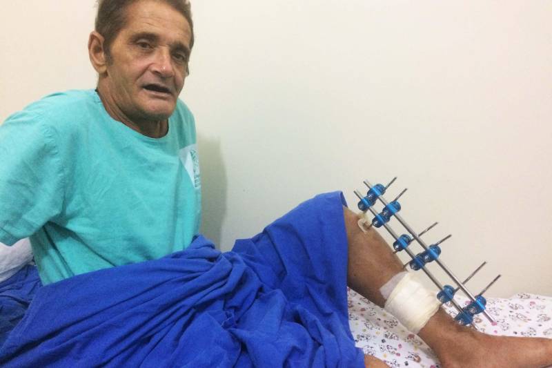 Os acidentes de trânsito são a causa de um a cada cinco atendimentos no Hospital Regional do Sudeste do Pará - Dr. Geraldo Veloso (HRSP), em Marabá (PA). A Unidade é referência em atendimento de trauma de média e alta complexidades e recebe a maioria das vítimas de trânsito em estado grave na região. Na foto, Valdevino Batista da Costa.
FOTO: ASCOM HRSP
DATA: 15.11.2018
BELÉM - PARÁ <div class='credito_fotos'>Foto: ASCOM HRSP | <a href='/midias/2018/originais/a0dd7b15-5778-41af-bab2-86b030953ae8.jpg' download><i class='fa-solid fa-download'></i> Download</a></div>