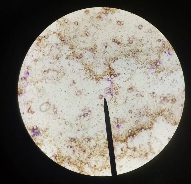 Pouca gente sabe, mas a Divisão de Entomologia do Laboratório Central do Estado (Lacen-PA) é responsável pelas pesquisas de campo que são fundamentais para o combate às endemias no Pará. A finalidade é observar e pesquisar o comportamento dos principais insetos transmissores de doenças como doença de Chagas, dengue, malária e leishmaniose e, assim, decidir qual a melhor estratégia de combate a ser usada. Tendo como responsável a bióloga entomologista Paoola Vieira, a Divisão trabalha, principalmente, integrada ao Departamento de Controle de Endemias da Secretaria de Estado de Saúde Pública (Sespa), setor que apresenta as demandas de ações de campo. "Trabalhamos com os vetores das principais endemias do estado: doenças de Chagas, leishmaniose, dengue e febre amarela. Então, o controle de todas as doenças transmitidas por vetores passa por aqui", informou Paoola. Na foto, lâmina enfectada de Trypanosoma Cruzi, extraído de Triatomíneo.
FOTO: ASCOM / SESPA
DATA: 03.05.2018
<div class='credito_fotos'>Foto: ASCOM SESPA | <a href='/midias/2018/originais/c7f6a4b8-16d9-4eba-abba-9dd7d3699aba.jpg' download><i class='fa-solid fa-download'></i> Download</a></div>