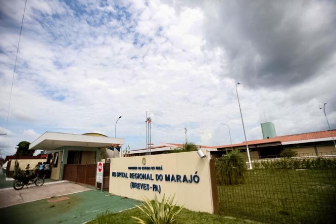 Uma cirurgia de alta complexidade e rara foi realizada pela equipe do Hospital Regional Público do Marajó (HRPM), em Breves, evitou o processo de amputação da perna de uma garota de apenas oito anos, que sofreu queda de uma árvore e provocou fratura externa da tíbia (mais conhecido como osso da canela) que exigiu a realização do procedimento de “rotação de retalhos de pele e subcutâneo vascularizados”, que devolveu a menina a chance de voltar a caminhar.

FOTO: DIVULGAÇÃO
DATA: 18.03.2019
BREVES - PA <div class='credito_fotos'>Foto: Divulgação   |   <a href='/midias/2019/originais/158ff90b-4001-469c-a436-28f8fbd1942d.jpg' download><i class='fa-solid fa-download'></i> Download</a></div>