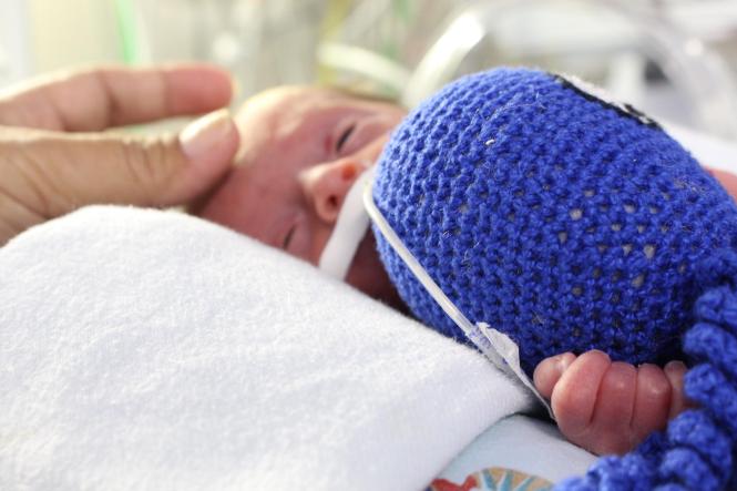 Bonecos de crochê em formato de polvo tem ajudado na recuperação de bebês prematuros internados na Unidade de Cuidados Intensivos (UCI) do Hospital Materno-Infantil de Barcarena Dra. Anna Turan (HMIB). Os bichinhos, que são confeccionados pelas mães que acompanham seus bebês internados ou por voluntários do Projeto Octos, são utilizados nos bercários e tem promovido acolhimento, aconchego, proteção e carinho aos bebês, se tornando objeto essencial durante o tratamento.

FOTO: ASCOM / HMIB
DATA: 11.03.2019
BARCARENA - PARÁ <div class='credito_fotos'>Foto: Nenhum   |   <a href='/midias/2019/originais/27628907-786c-4b61-823c-6b3a0d3446e8.jpg' download><i class='fa-solid fa-download'></i> Download</a></div>