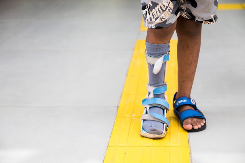 CIIR 03/12/2019

Assistência e reabilitação de pessoas com deficiência.
Na foto: 
 <div class='credito_fotos'>Foto: Pedro Guerreiro / Ag. Pará   |   <a href='/midias/2019/originais/5722_0a302eab-ad7f-819e-1914-c6699af7648b.jpg' download><i class='fa-solid fa-download'></i> Download</a></div>