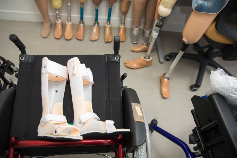 CIIR 03/12/2019

Assistência e reabilitação de pessoas com deficiência.
Na foto: 
 <div class='credito_fotos'>Foto: Pedro Guerreiro / Ag. Pará   |   <a href='/midias/2019/originais/5722_a2f90964-c3e4-18ac-71ab-86e558e7fb10.jpg' download><i class='fa-solid fa-download'></i> Download</a></div>