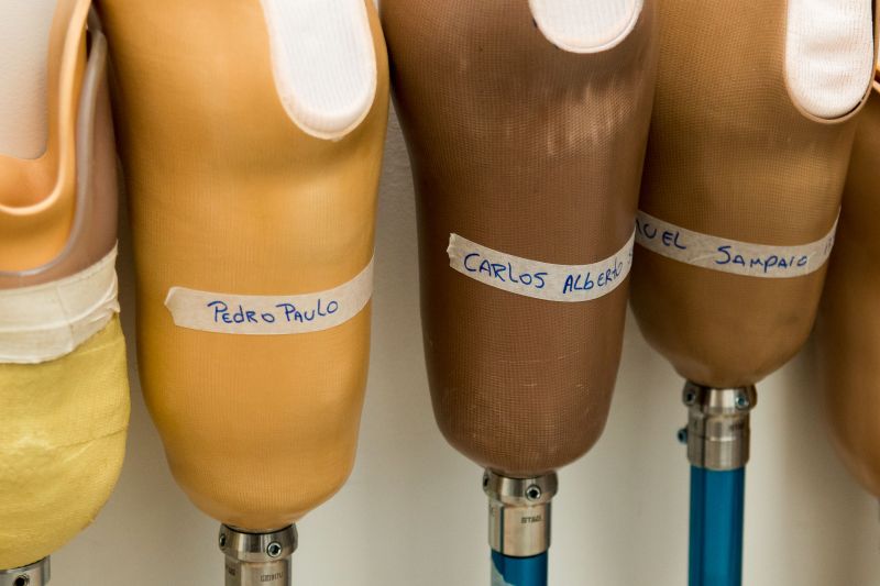 CIIR 03/12/2019

Assistência e reabilitação de pessoas com deficiência.
Na foto: 
 <div class='credito_fotos'>Foto: Pedro Guerreiro / Ag. Pará   |   <a href='/midias/2019/originais/5722_b0484b96-08c7-e234-aaf6-d5357e9bee81.jpg' download><i class='fa-solid fa-download'></i> Download</a></div>