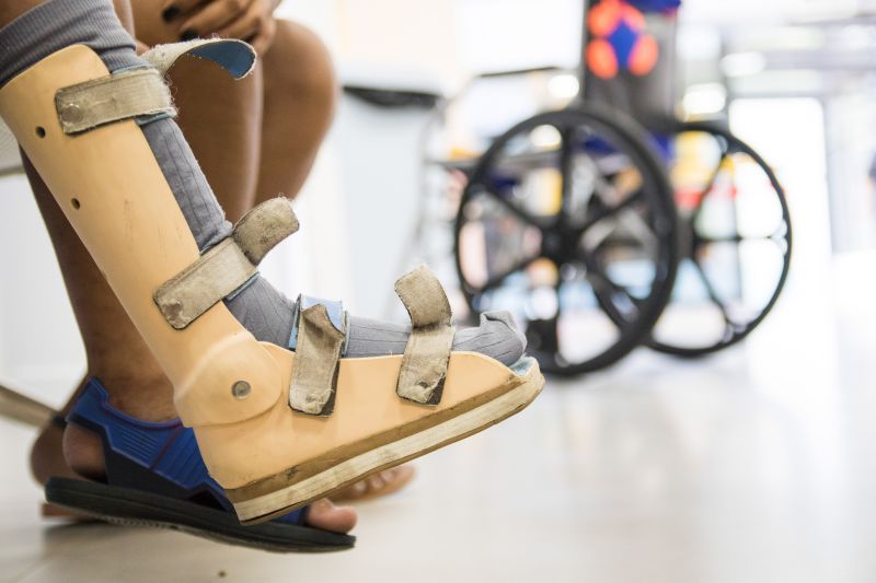 CIIR 03/12/2019

Assistência e reabilitação de pessoas com deficiência.
Na foto: 
 <div class='credito_fotos'>Foto: Pedro Guerreiro / Ag. Pará   |   <a href='/midias/2019/originais/5722_fdbf5563-ec68-8851-f359-a14389390376.jpg' download><i class='fa-solid fa-download'></i> Download</a></div>