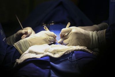 notícia: Fundação Santa Casa realiza mutirão de cirurgias de vasectomia