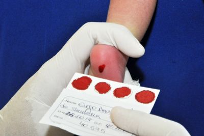 notícia: Uremia e Lacen-PA assumem o Teste do Pezinho no Pará