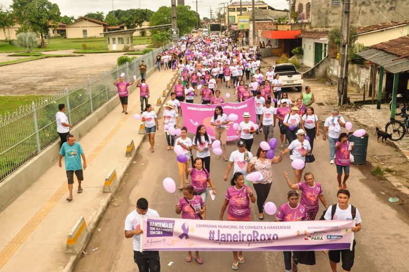 Uma grande mobilização no município de Marituba marcou, neste domingo (26), o Dia Mundial de Luta contra a Hanseníase. A ação foi organizada pela Secretaria De Estado de Saúde Pública (Sespa), Secretaria Municipal de Saúde (Sesau) e Movimento de Reintegração das Pessoas Atingidas pela Hanseníase (Morhan). <div class='credito_fotos'>Foto: José Pantoja/ Sespa | <a href='/midias/2020/originais/5921_5abe6753-4719-cf0d-1063-f88e0a2bf4dc.jpg' download><i class='fa-solid fa-download'></i> Download</a></div>