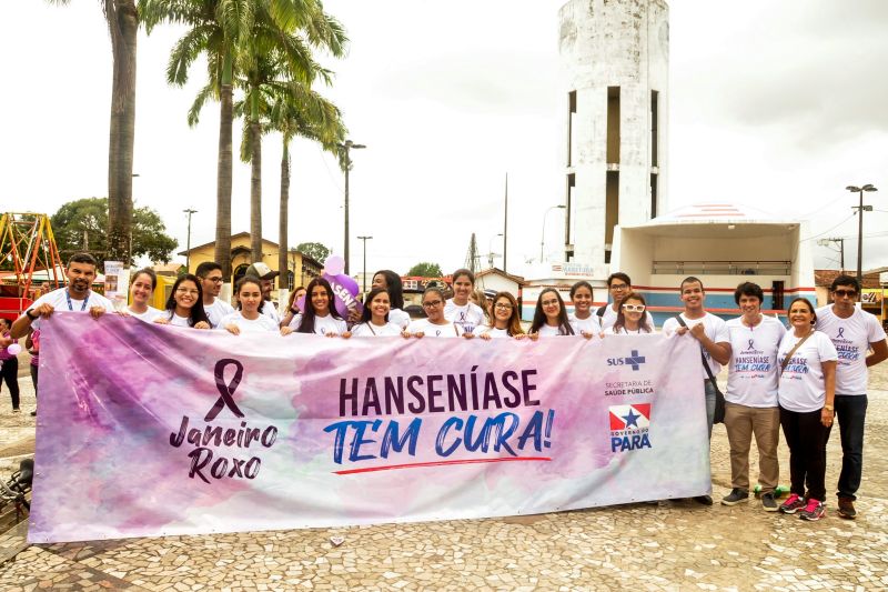 Uma grande mobilização no município de Marituba marcou, neste domingo (26), o Dia Mundial de Luta contra a Hanseníase. A ação foi organizada pela Secretaria De Estado de Saúde Pública (Sespa), Secretaria Municipal de Saúde (Sesau) e Movimento de Reintegração das Pessoas Atingidas pela Hanseníase (Morhan). <div class='credito_fotos'>Foto: José Pantoja/ Sespa | <a href='/midias/2020/originais/5921_f87aef5f-3791-dab0-7610-71b04953a975.jpg' download><i class='fa-solid fa-download'></i> Download</a></div>