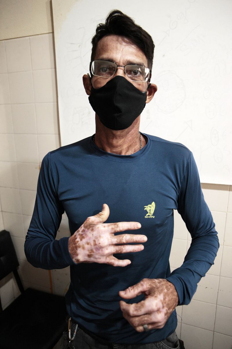 Atendimentos Dermatológicos UEPA
Na foto; José Claudio, paciente dermatológico. <div class='credito_fotos'>Foto: Bruno Cecim / Ag.Pará | <a href='/midias/2020/originais/6533_2186e2cc-8e12-b935-3781-e65a939fc17b.jpg' download><i class='fa-solid fa-download'></i> Download</a></div>