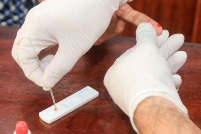 notícia: Procon alerta sobre obrigatoriedade de teste sorológico por plano de saúde