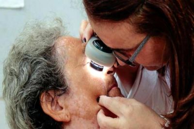 notícia: Serviço de Dermatologia oferece atendimento especializado em Psoríase