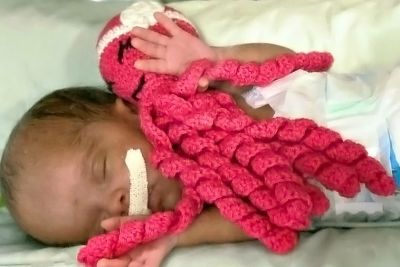 notícia: 'Polvinhos' auxiliam na recuperação de bebês prematuros em Marabá