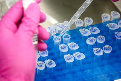 notícia: Laboratório público identifica novo coronavírus em 77% das amostras analisadas no Oeste do Pará