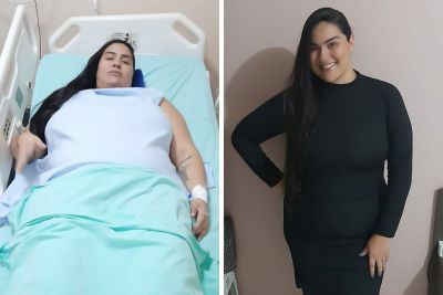 Luanara Saliba, 32, fez a bariátrica e afirma que sua vida mudou