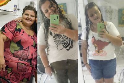 notícia: Retomada do Programa Obesidade Zero é motivo de esperança para pacientes