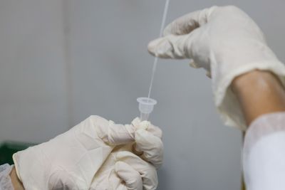 notícia: Procon orienta sobre a inclusão de testes de covid-19 na lista de procedimentos de cobertura obrigatória dos planos de saúde