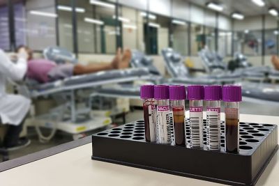 notícia: Hemopa informa novo horário de funcionamento para coleta de sangue em Belém