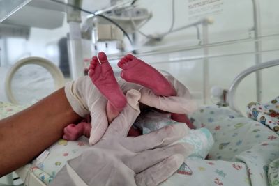 notícia: Santa Casa destaca importância do teste do pezinho para a saúde das crianças