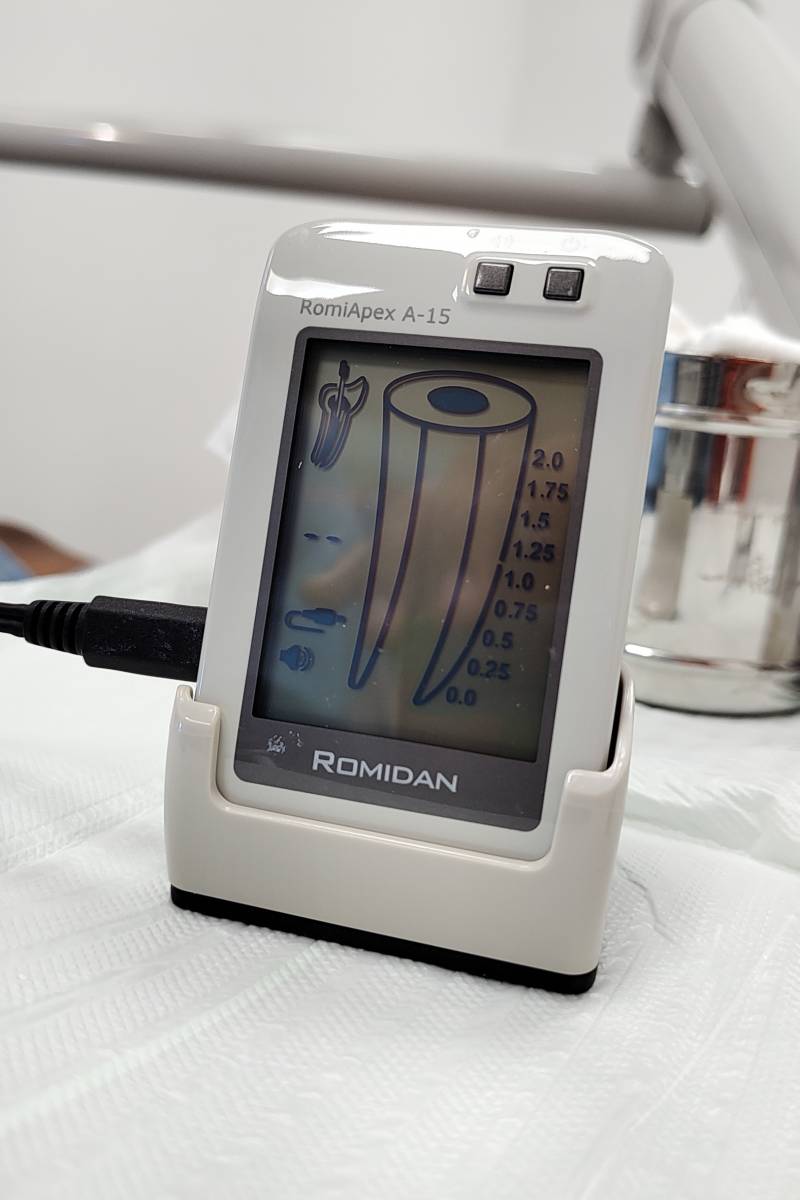 Localizador apical, um equipamento que permite um atendimento ainda mais eficiente.