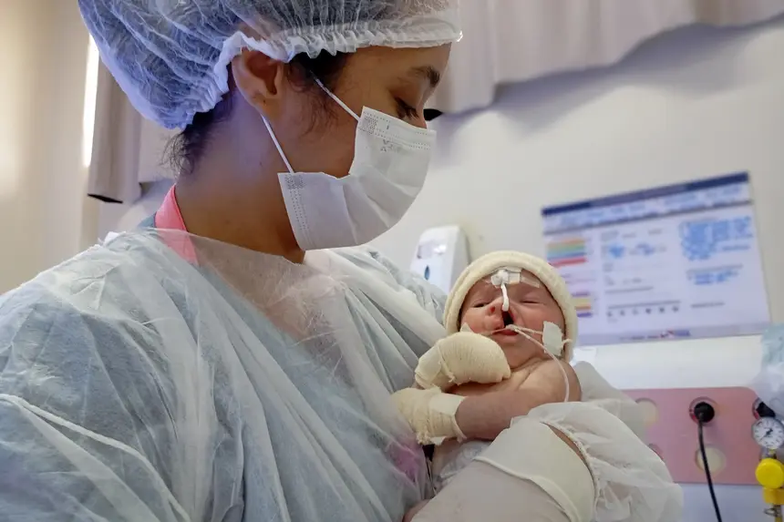 Yasmin nasceu com fissura labiopalatina