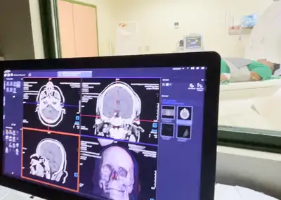 notícia: Em Altamira, exame com sedação assegura conforto a pacientes com neuropatologias