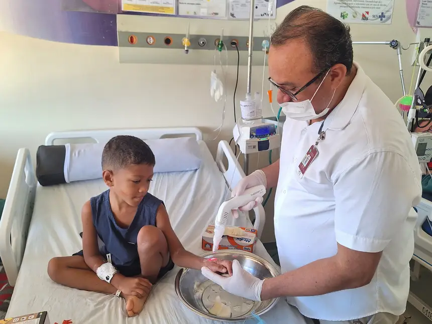 A laserterapia ajudou na cicratização das lesões na mão do paciente