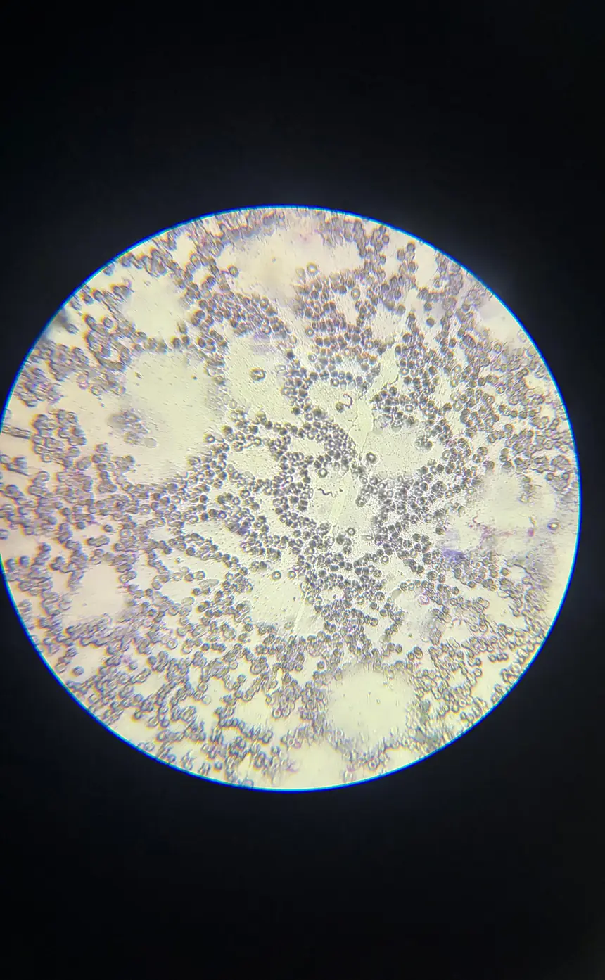Lâmina sanguínea com parasitas T. cruzi, observada por meio de microscópio presente no espaço da Biologia do CCPPA.
