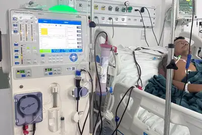 notícia: Hospital de Oriximiná realizou 206 sessões de hemodiálise em pacientes da UTI em 2025