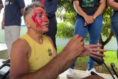 Aldeni Oliveira, agente que simulou v&iacute;tima, j&aacute; sofreu acidente e compartilhou experi&ecirc;ncia